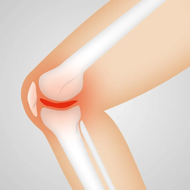 How PT Can Help with Your Knee Replacement
